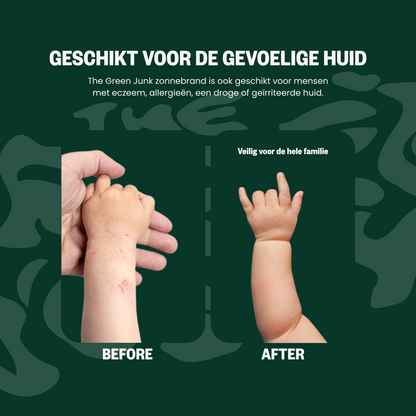 The Green Junk - Natuurlijke Zonnebrand 200ML (4-pack)